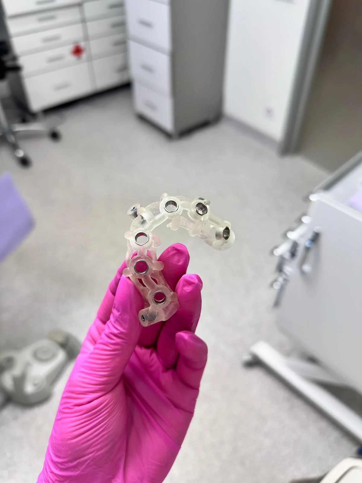 半透明3D打印聚合物牙科手术导板，带有嵌入式金属嵌件。 - Pexels

